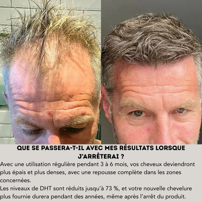 Oviris™ Repousse Capillaire