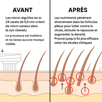 Oviris™ Repousse Capillaire