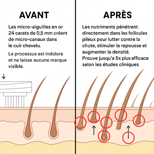 Oviris™ Repousse Capillaire