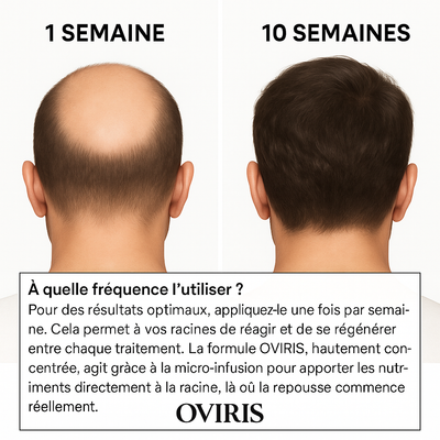 Oviris™ Repousse Capillaire