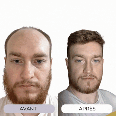 Oviris™ Repousse Capillaire