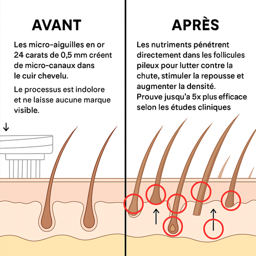 Oviris™ Repousse Capillaire